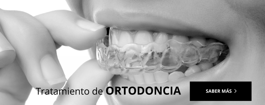 Ortodoncia La Mata